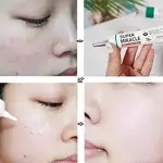 سوم باي مي كريم سوبر ميركل لإزالة جميع شوائب البشرة 30 مل